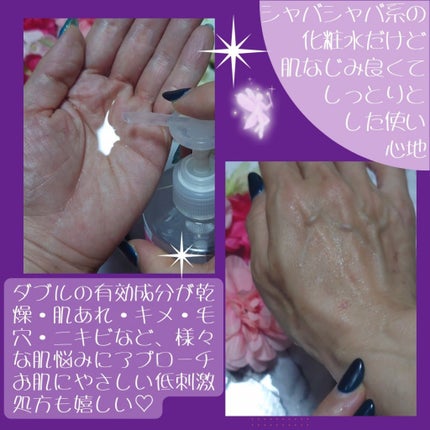 ヘパトリート 薬用保湿化粧水/ゼトックスタイル/化粧水を使ったクチコミ(3枚目)