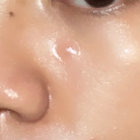 エイクリアスポットキュアパッチ/Dr.G/その他スキンケアを使ったクチコミ(3枚目)