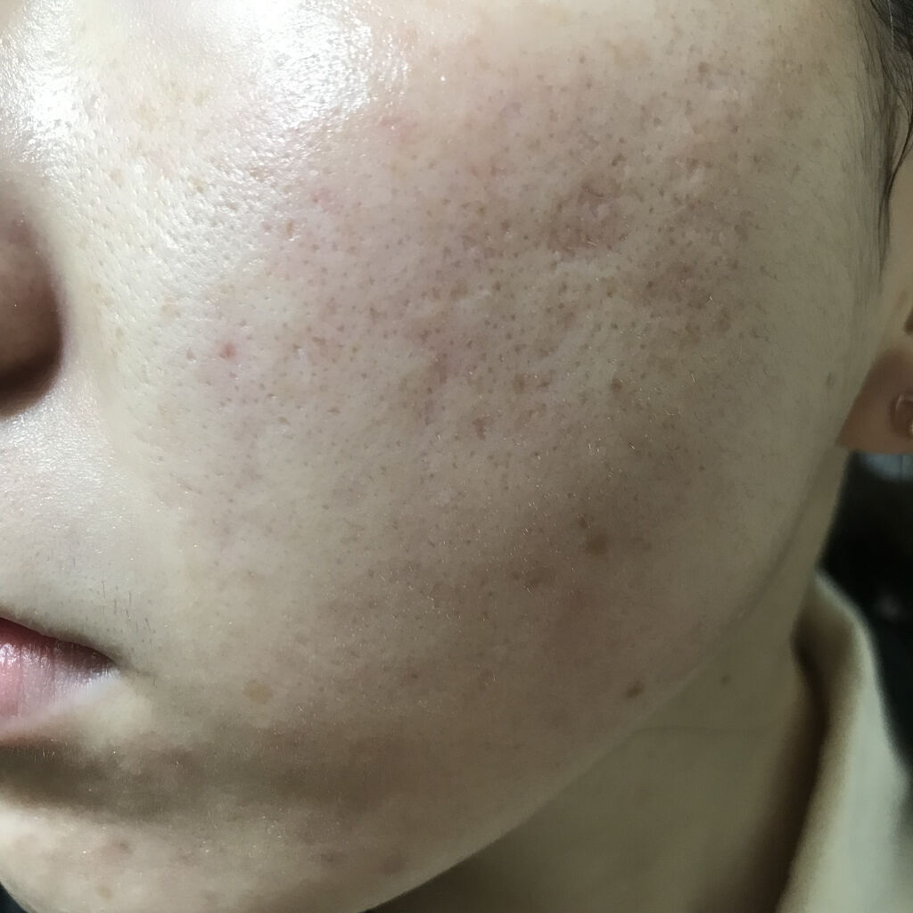 SULFUR OINTMENT/De La Cruz/その他スキンケアを使ったクチコミ（2枚目）