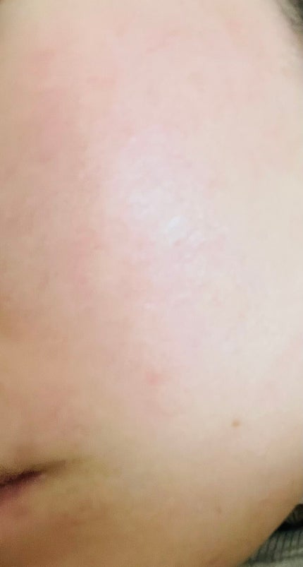 オバジC10セラム/オバジ/美容液を使ったクチコミ(1枚目)