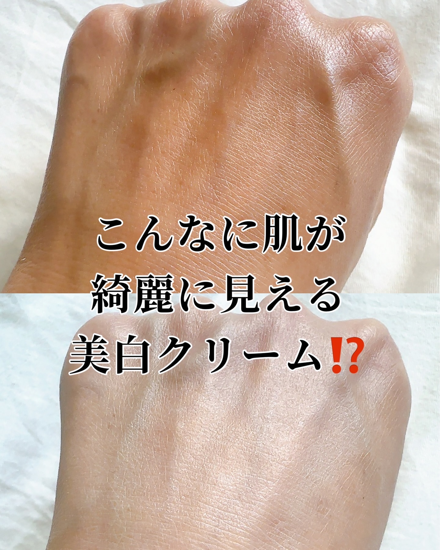 セメンリトピコトニックショットアンプル/Dr.Melaxin/美容液を使ったクチコミ（1枚目）