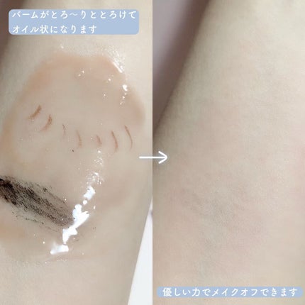 マヌカハニー クレンジングバーム/アピセラピーコスメティクス/クレンジングバームを使ったクチコミ(5枚目)