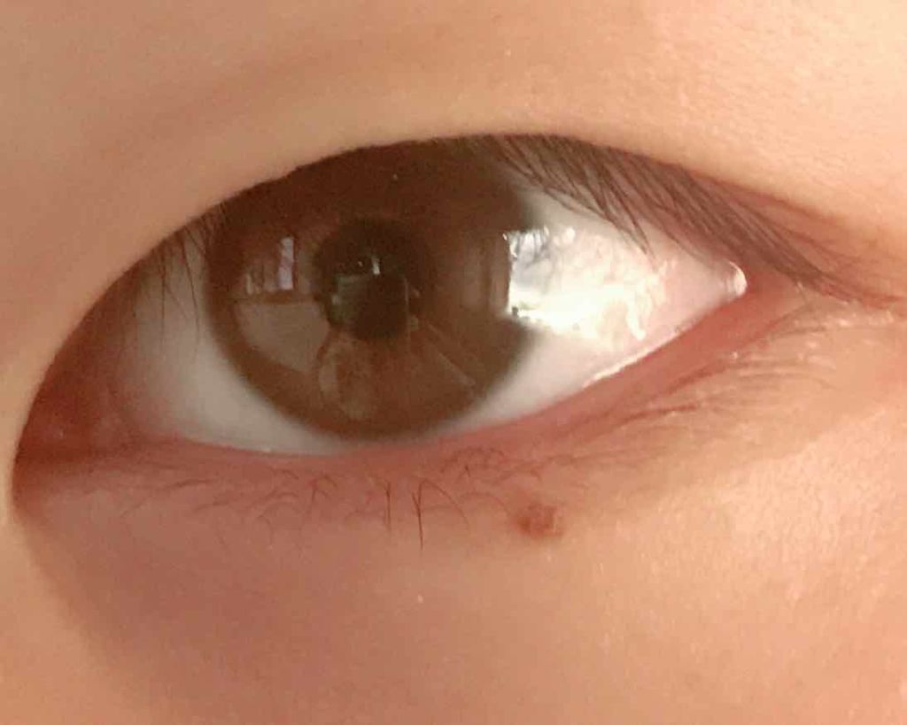 アイビューティー フィクサー WP/アストレア ヴィルゴ/二重まぶた用アイテムを使ったクチコミ（2枚目）