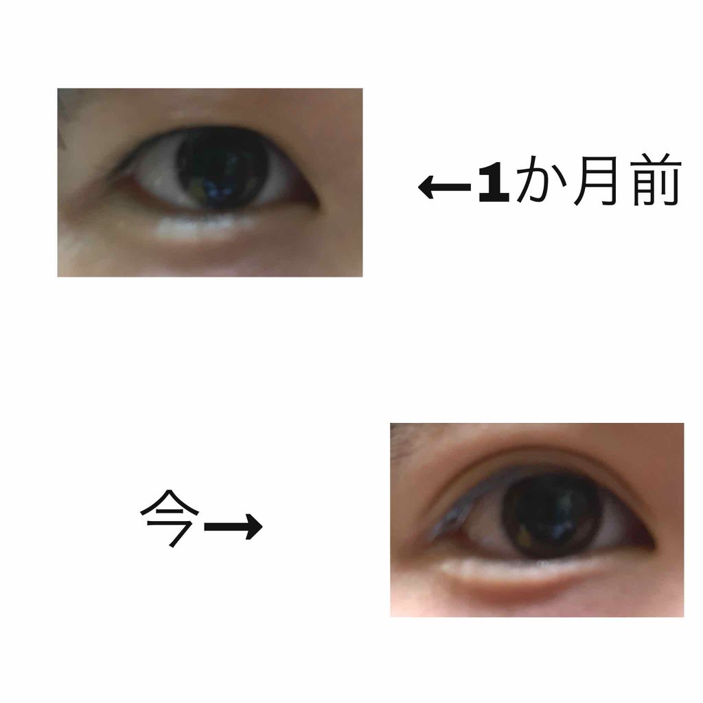 ふたえテープ 目立たず肌になじむ絆創膏タイプ/DAISO/二重まぶた用アイテムを使ったクチコミ（2枚目）