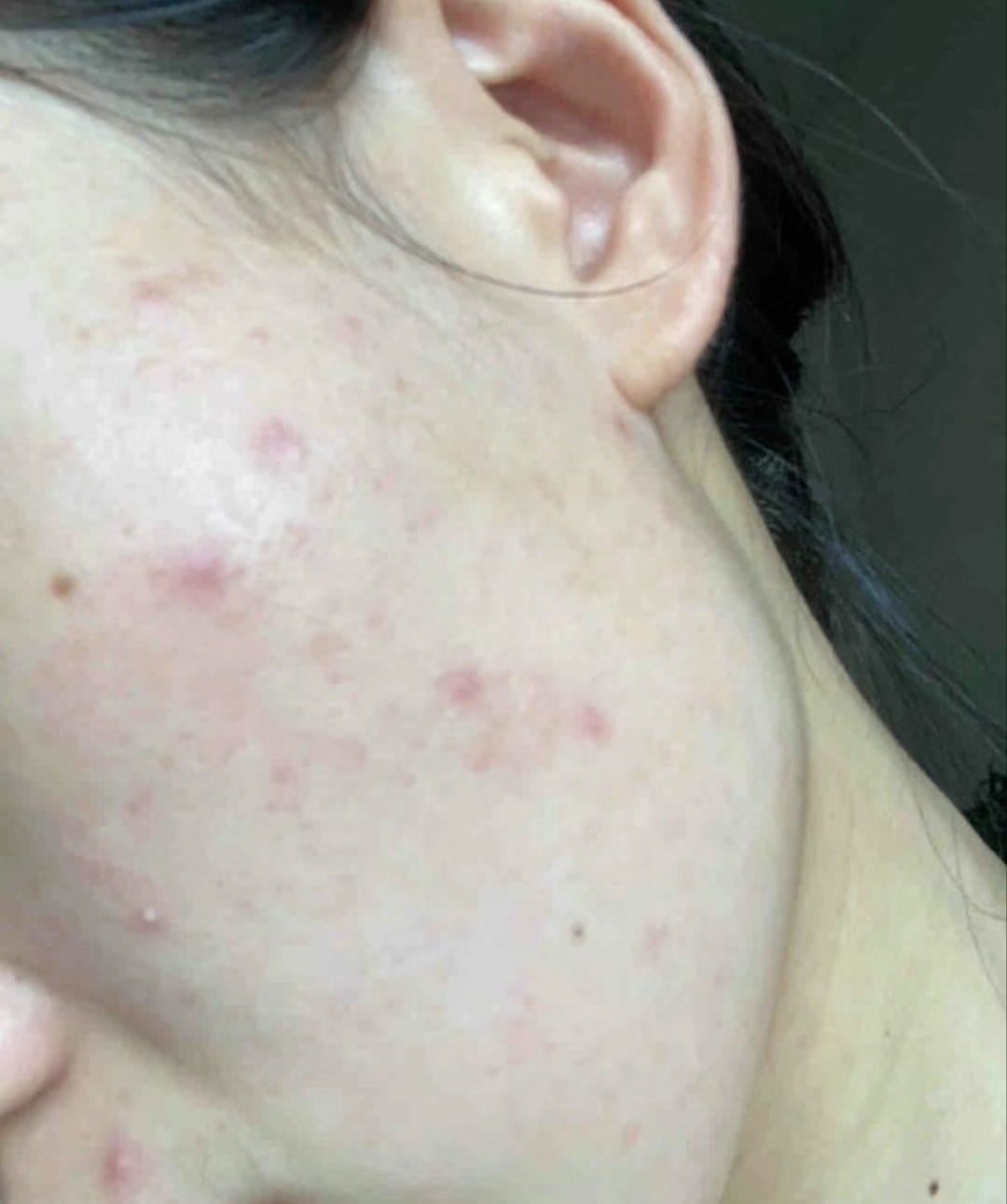 ハトムギ化粧水(ナチュリエ スキンコンディショナー R )/ナチュリエ/化粧水を使ったクチコミ（1枚目）