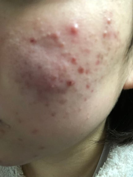 マイルドクレンジング オイル/ファンケル/オイルクレンジングを使ったクチコミ(1枚目)