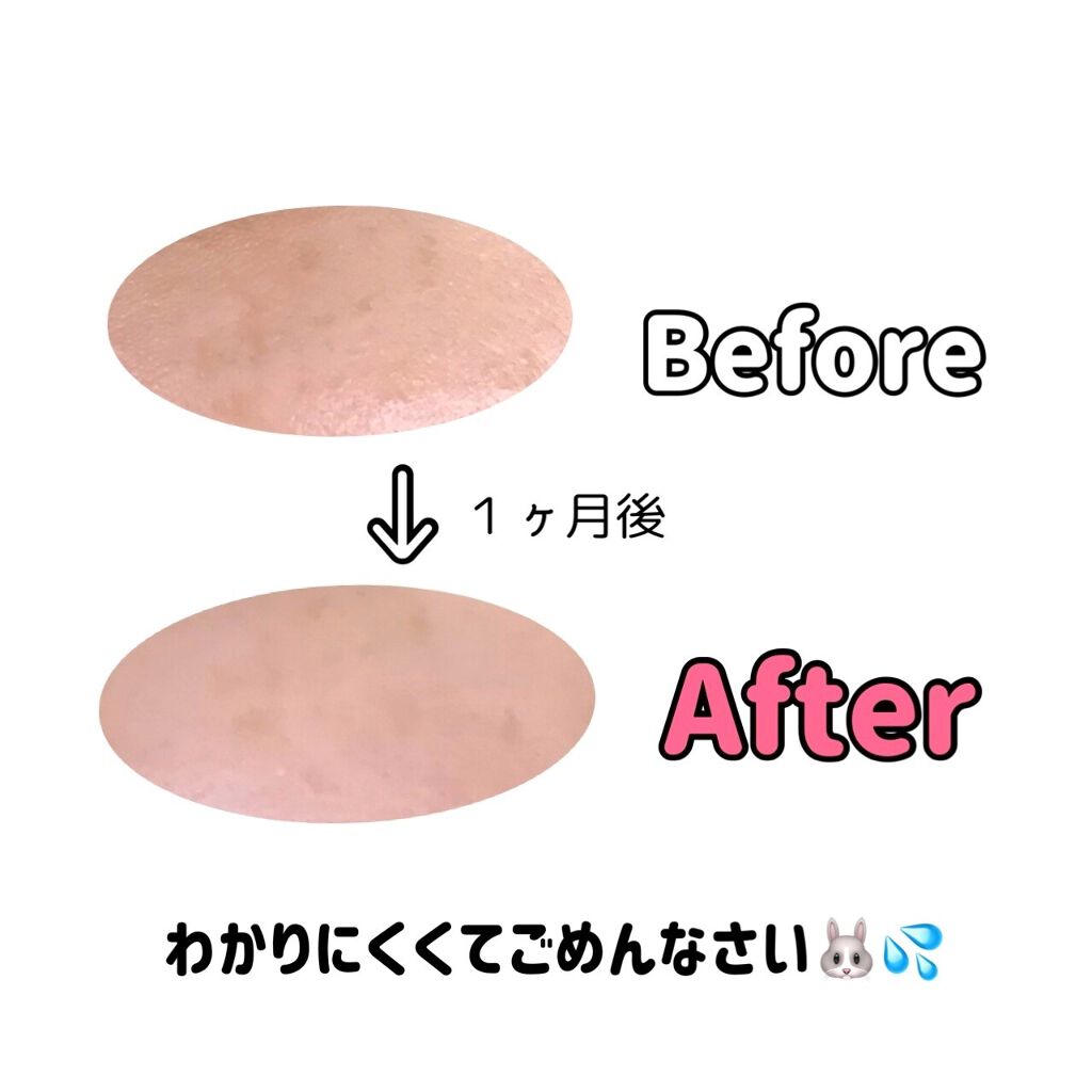 ハイチオールCホワイティア(医薬品)/ハイチオールC/その他を使ったクチコミ（3枚目）