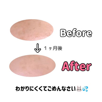 ハイチオールCホワイティア(医薬品)/ハイチオールC/その他を使ったクチコミ(3枚目)