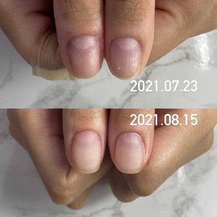 ナイトリニューハンドクリーム/コエンリッチQ10/ハンドクリームを使ったクチコミ(6枚目)