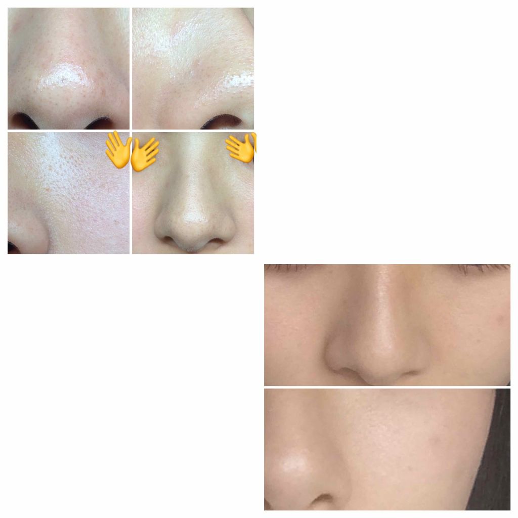 デュオ ザ クレンジングバーム Duoを使った口コミ 初投稿です 読みにくかったりしたらすみませ By たぴ 乾燥肌 10代前半 Lips