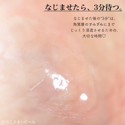 タカミスキンピール/タカミ/ブースター・導入液を使ったクチコミ(5枚目)