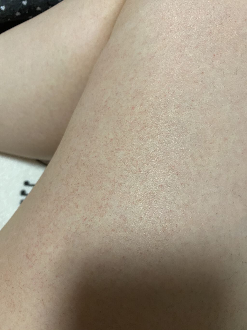 ジョンソン ベビーオイル 無香料/ジョンソンベビー/ボディオイルを使ったクチコミ（2枚目）