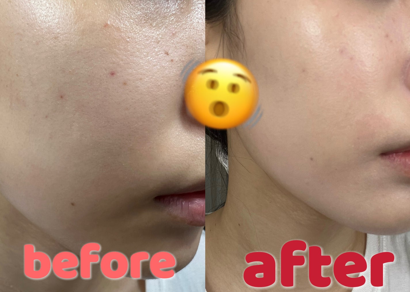 ベアウォータークッション/rom&nd/クッションファンデーションを使ったクチコミ(5枚目)