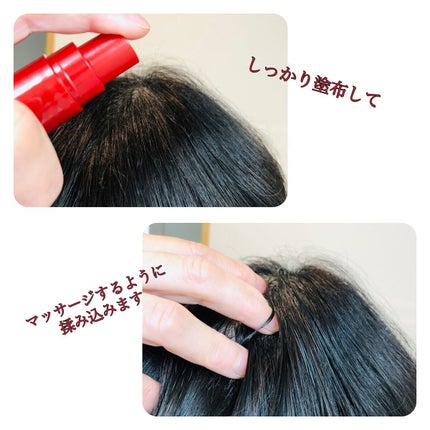 薬用育毛剤/FUSARI/頭皮ローションを使ったクチコミ(5枚目)