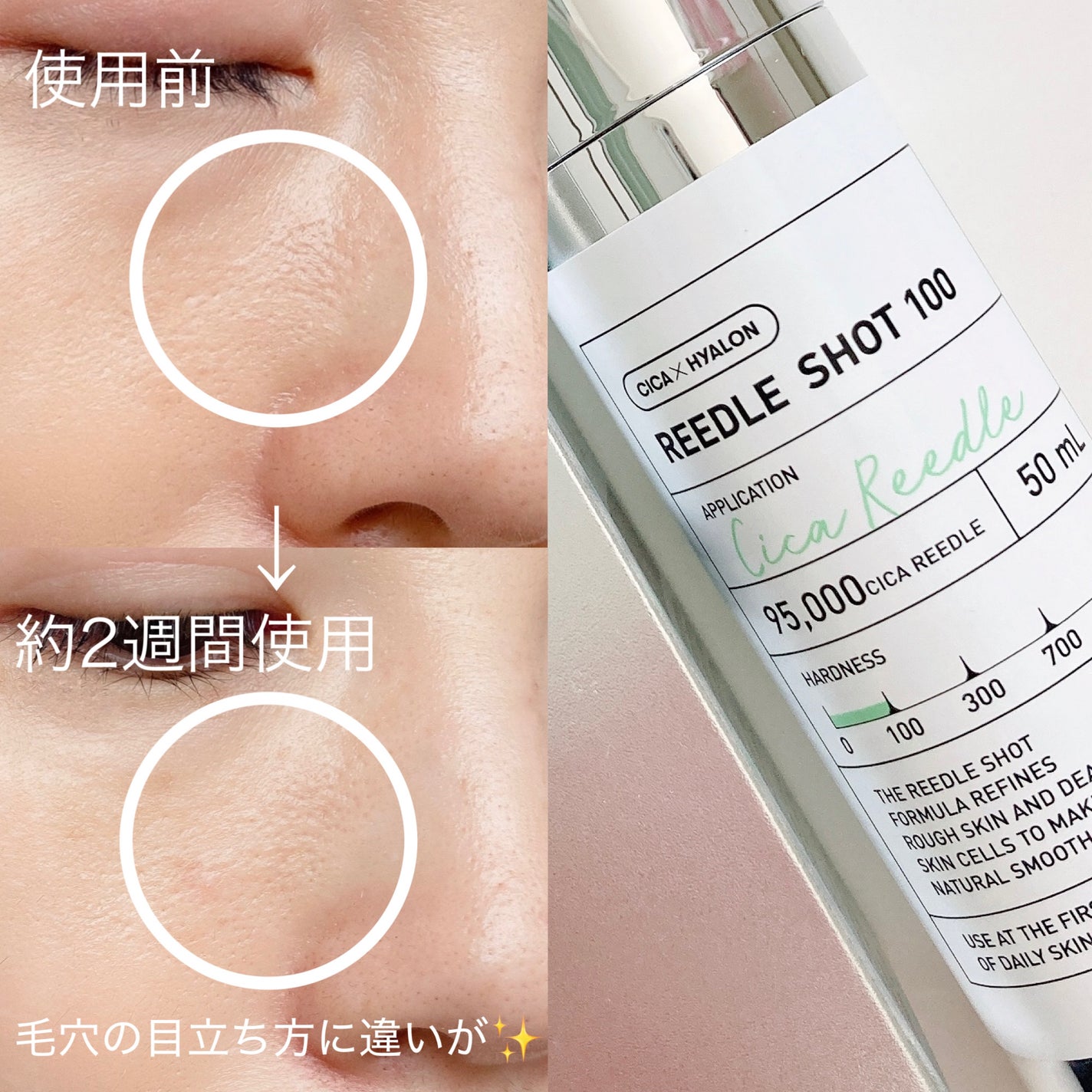 シカバイタル エッセンス/VT/美容液を使ったクチコミ(2枚目)