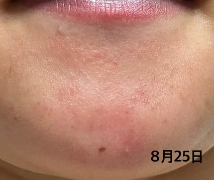 を使ったクチコミ(3枚目)