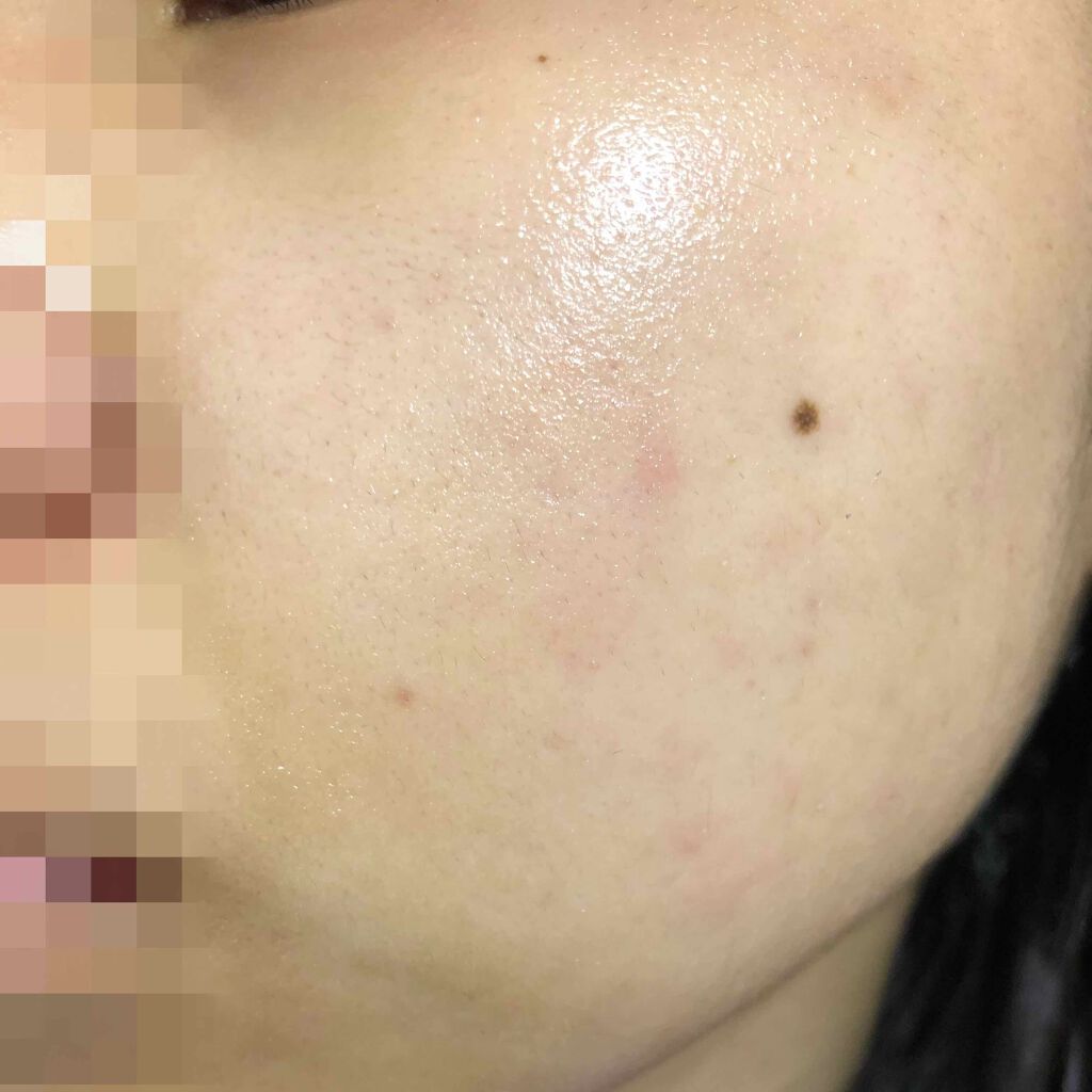 化粧水・敏感肌用・高保湿タイプ/無印良品/化粧水を使ったクチコミ（2枚目）