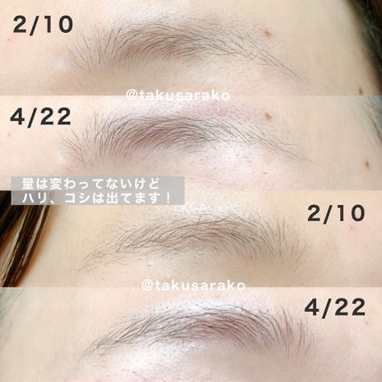 アイズワイズクリエイター/グランフィクサー/まつげ美容液を使ったクチコミ(5枚目)