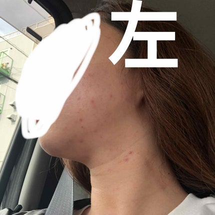 chibi_na on LIPS 「まだ汚いけど、これだけきれいになった😳1、2枚目は今日の写真3..」(4枚目)