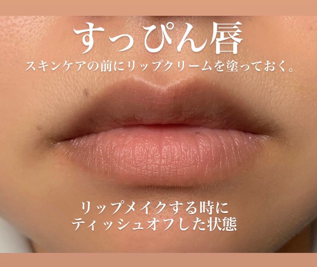 三十路後半 on LIPS 「むっちりリップの仕込み方です。毛穴がお見苦しいですがご容赦を…..」(2枚目)