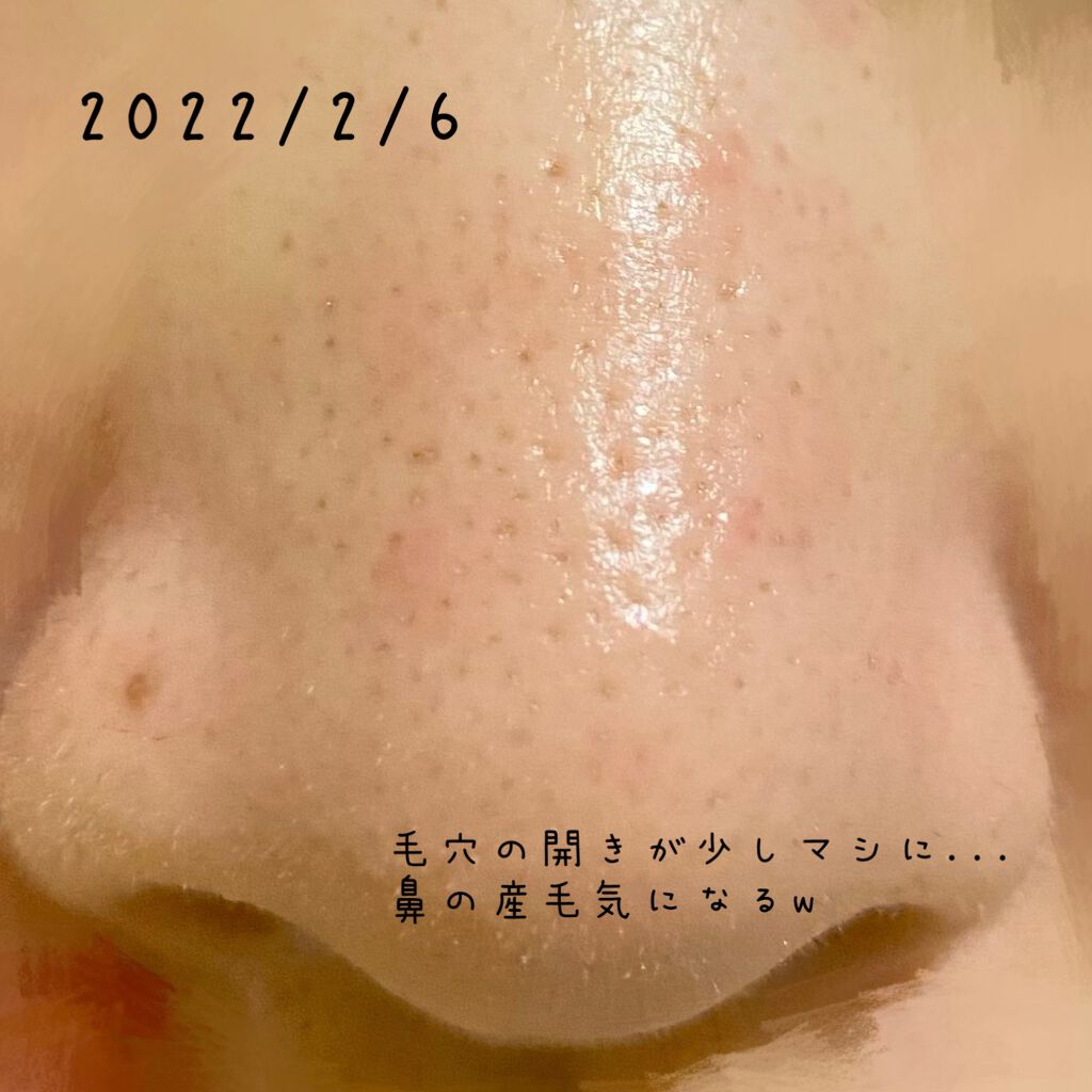 モイスチュア リポソーム/DECORTÉ/美容液を使ったクチコミ(6枚目)