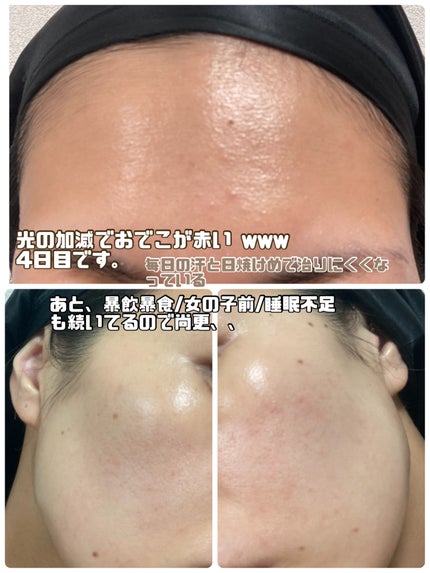 パンテショット675/COSNORI/美容液を使ったクチコミ(7枚目)