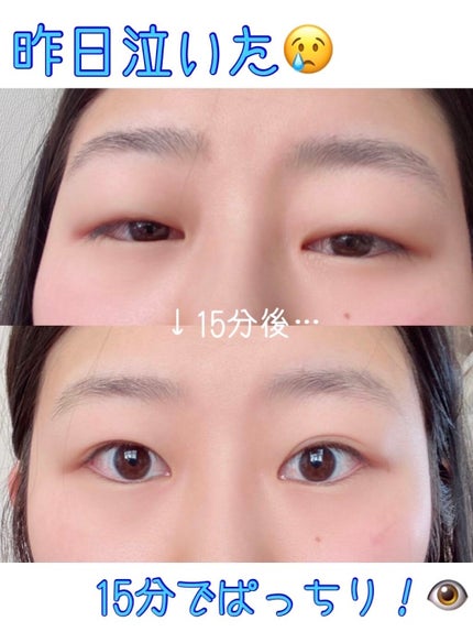 e on LIPS 「泣いたまま寝たら目が腫れちゃった💦そんな朝の救世主🦸♂️15..」(1枚目)