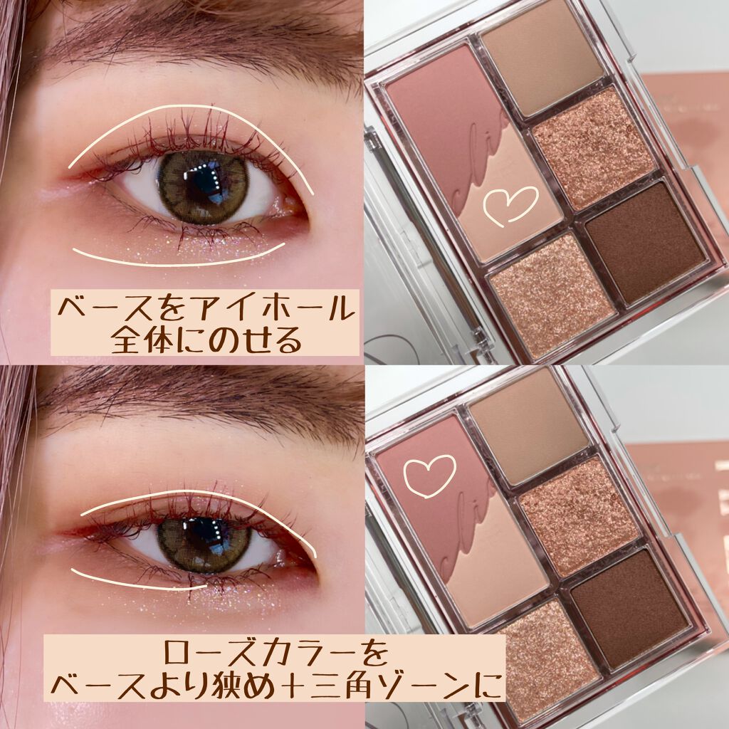 ãã³ã°ïŒã«ãŒã«ãã¹ã«ã© ã¢ããã³ã¹ããã£ã«ã /ããã€ã³ã¡ã€ã¯/ãã¹ã«ã©ã䜿ã£ãã¯ãã³ãïŒ2æç®ïŒ