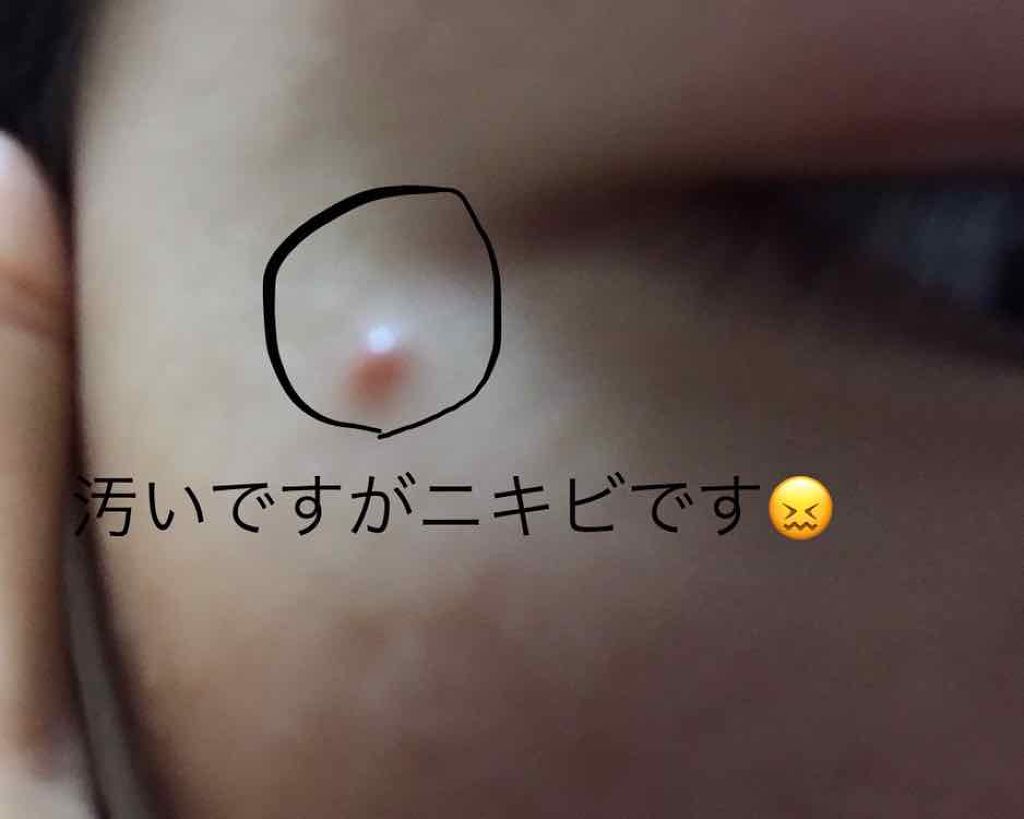 スポッツカバー ファウンデイション/SHISEIDO/クリームコンシーラーを使ったクチコミ(2枚目)