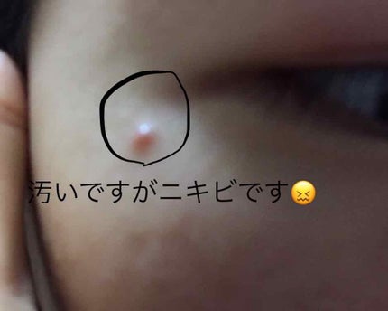 スポッツカバー ファウンデイション/SHISEIDO/クリームコンシーラーを使ったクチコミ(2枚目)