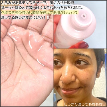 jasmine on LIPS 「＼トラネキサム酸配合の医薬部外品化粧水がめちゃくちゃよかった🙌..」（5枚目）