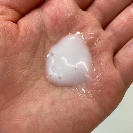 モイスチュア ローション/カルテHD/化粧水を使ったクチコミ(5枚目)