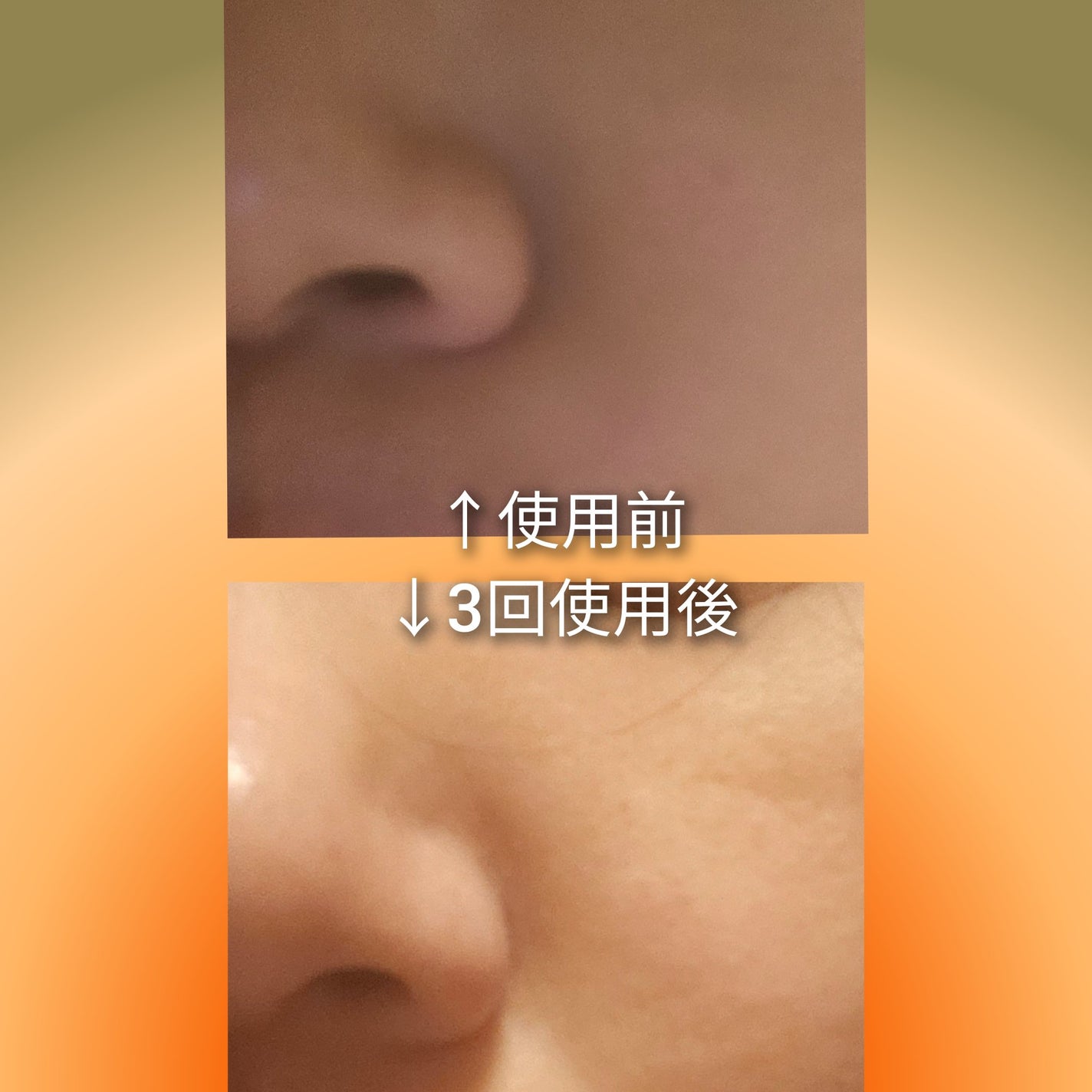 角質スッキリ毛穴パック /HANYUL(ハンユル)/洗い流すパック・マスクを使ったクチコミ(2枚目)