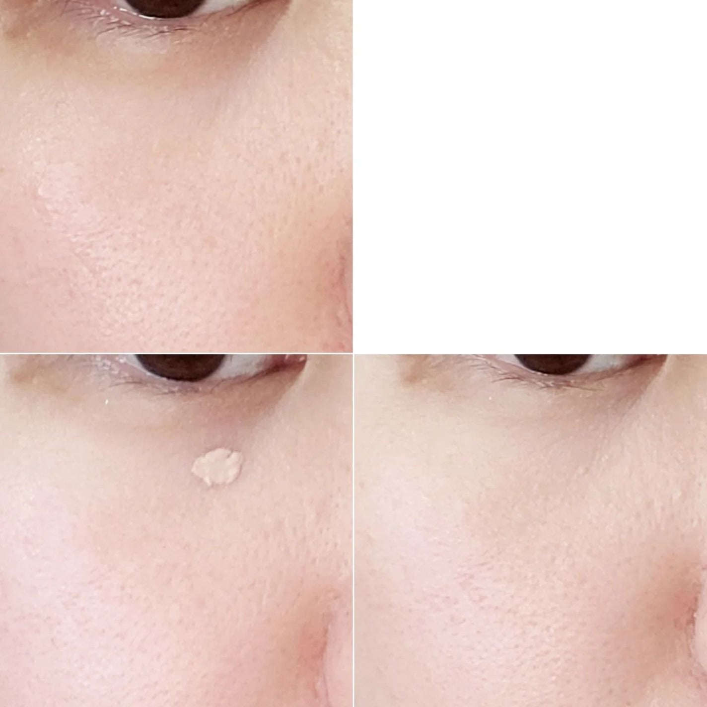 カリプソ マジックコンシーラー/カリプソ/コンシーラーを使ったクチコミ(4枚目)