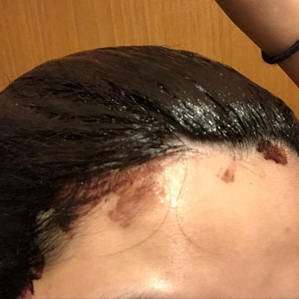 クロカミシャンプー/iqumore/市販シャンプーを使ったクチコミ(7枚目)