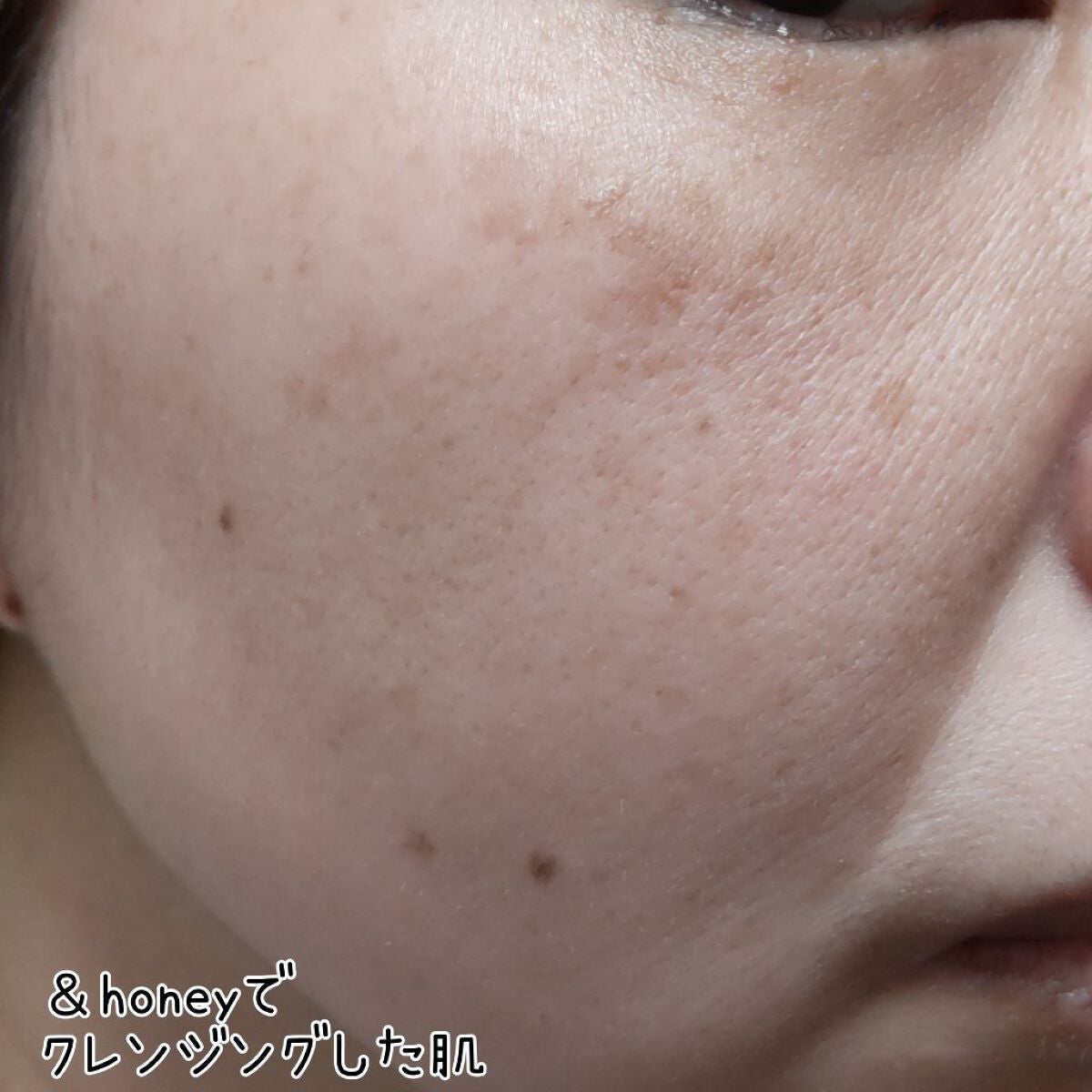 &honey クレンジングバーム モイスト/&honey/クレンジングバームを使ったクチコミ(5枚目)