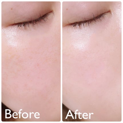 エファクラ ピールケア セラム/ラ ロッシュ ポゼ/美容液を使ったクチコミ(5枚目)