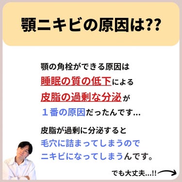 あなたの肌に合ったスキンケア💐コーくん on LIPS 「【知らないと損】アソコ10秒温めるとニキビエグい消える.あなた..」（3枚目）