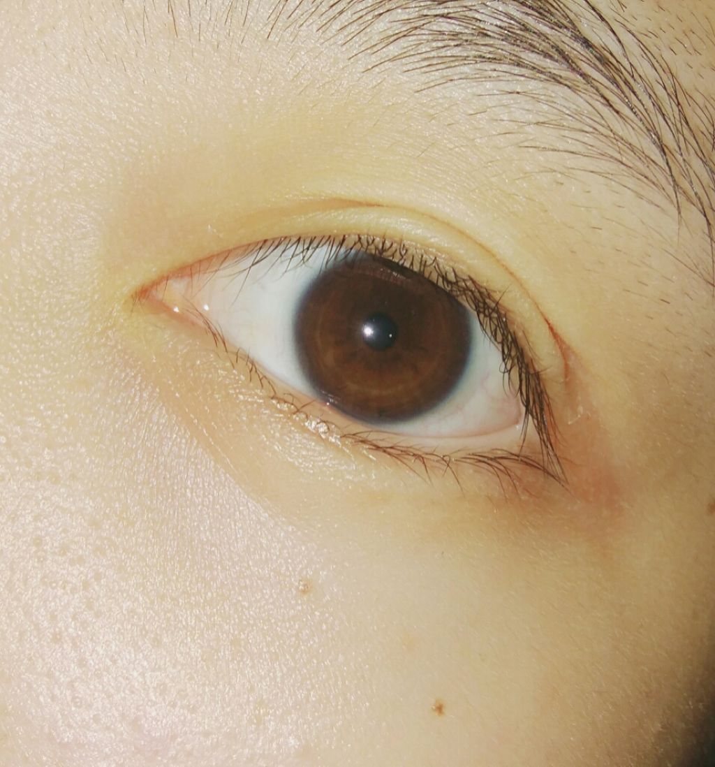 アイテープ片面(のびる)絆創膏タイプ スリム 120枚/セリア/二重まぶた用アイテムを使ったクチコミ（1枚目）