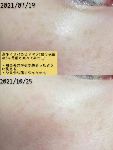 ビタペアC 集中美容液スペシャルセット/ネイチャーリパブリック/美容液を使ったクチコミ(3枚目)