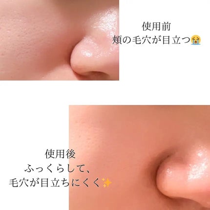 ちゃんあい¨̮⃝ on LIPS 「メディキューブ様より提供いただき、コラーゲンナイトラッピングマ..」(4枚目)