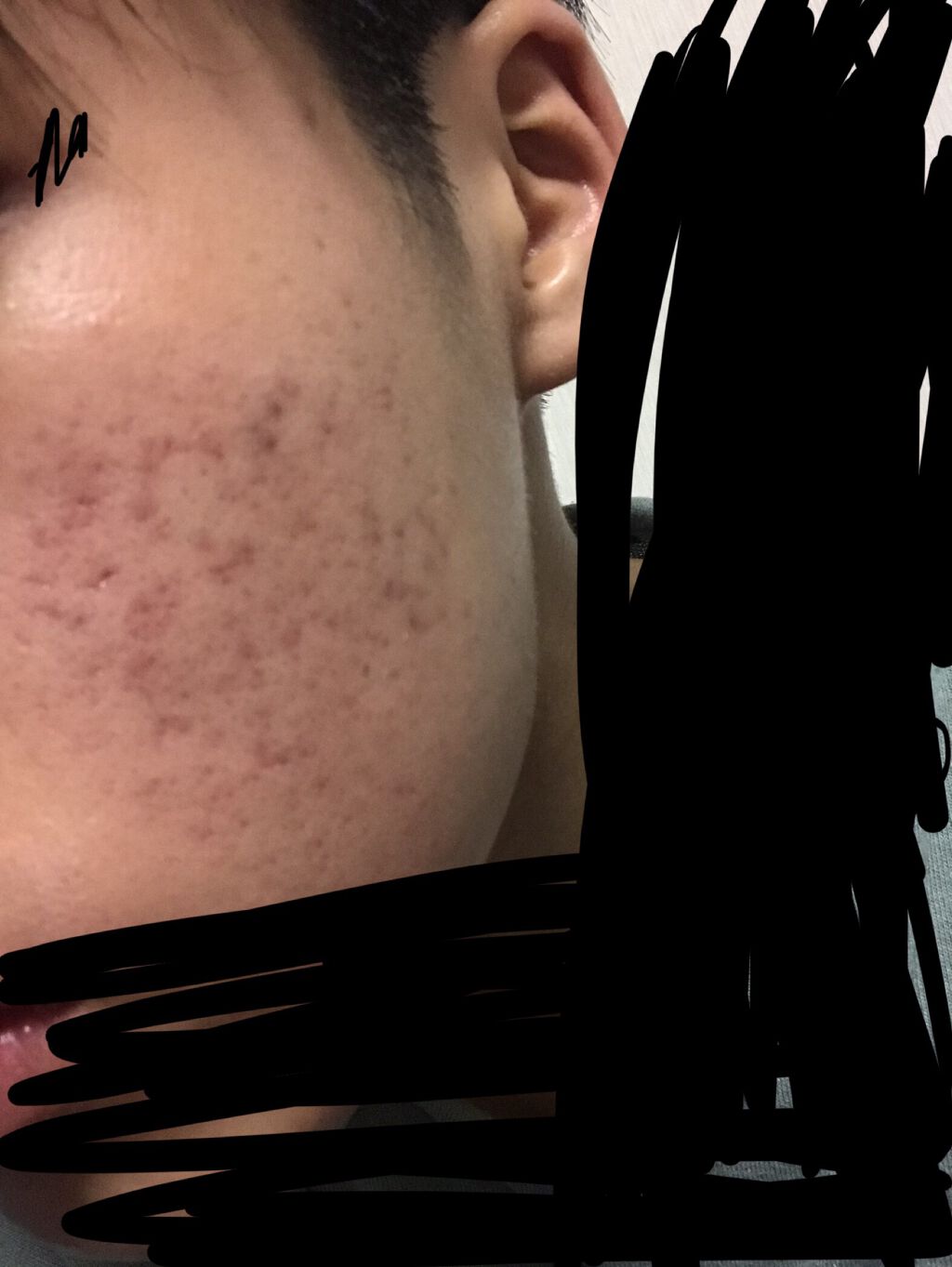 薬用しみ対策 美白化粧水/メラノCC/化粧水を使ったクチコミ（1枚目）