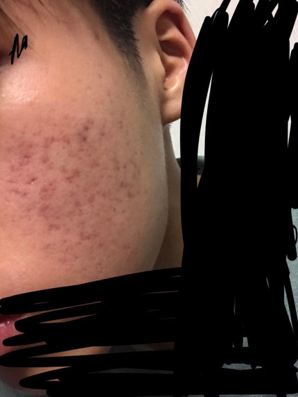 薬用しみ対策 美白化粧水/メラノCC/化粧水を使ったクチコミ(1枚目)