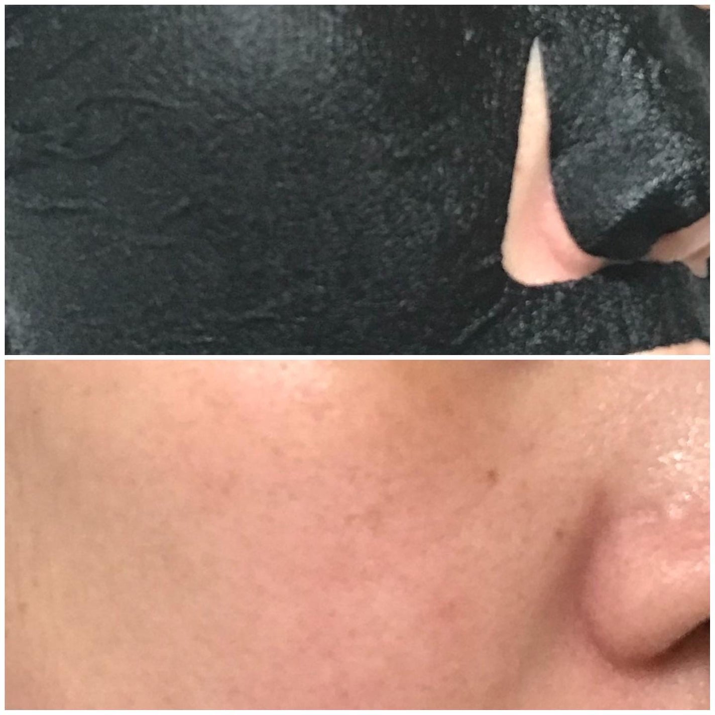 ルルルン ハイドラ F マスク/ルルルン/シートマスク・パックを使ったクチコミ(3枚目)