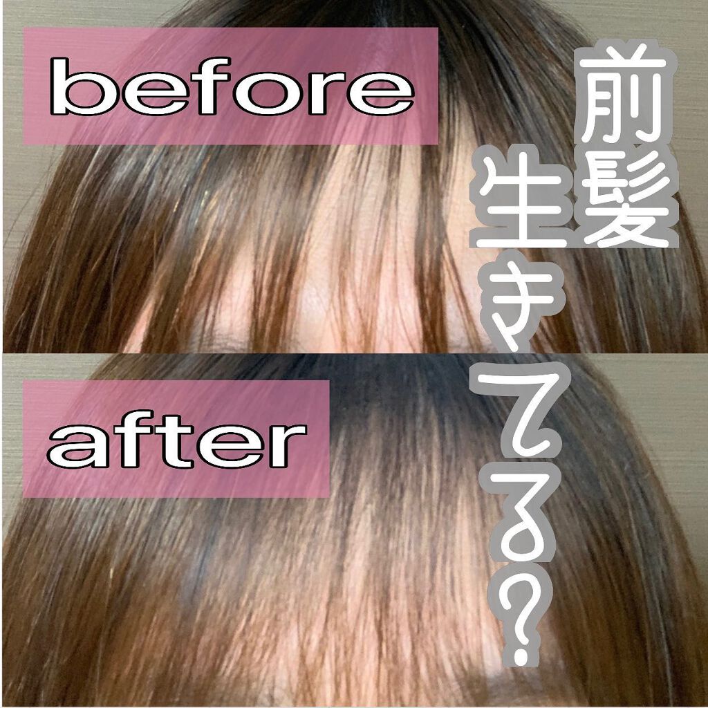 本日は、わたしがやっている
前髪復活術を公開したいと思います！

脂性肌のわたしは、
いつも前髪がベタついてしまって
とても嫌だったんですけど
これをしてから前髪が1日中サラサラです！

そこで使用しているのが、
⭐️CANMAKE
　　オ