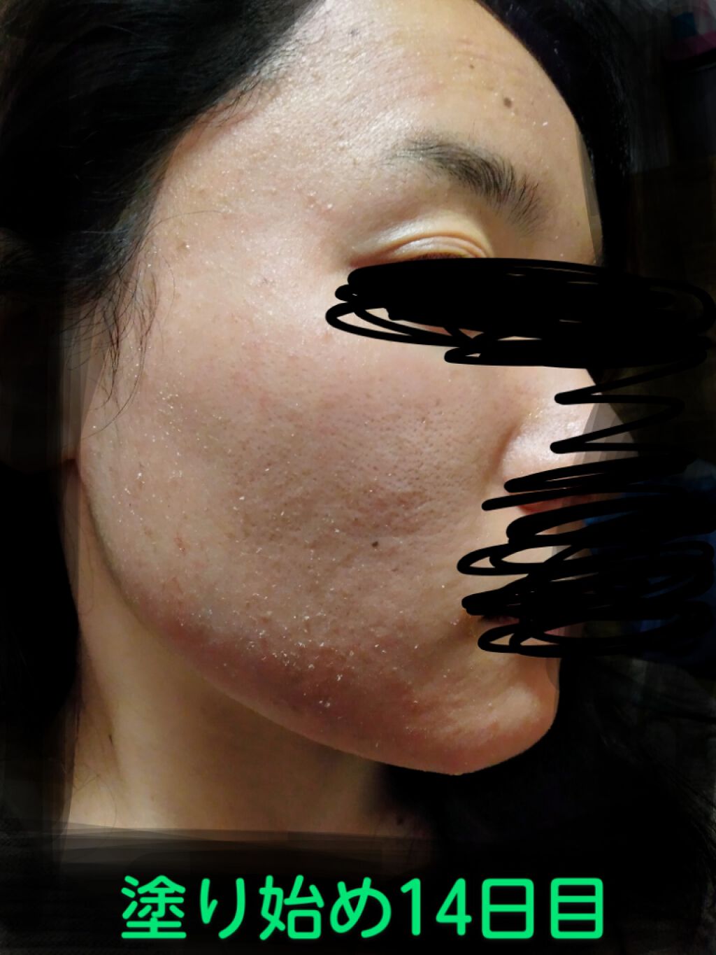 日本酒の化粧水/菊正宗/化粧水を使ったクチコミ（1枚目）