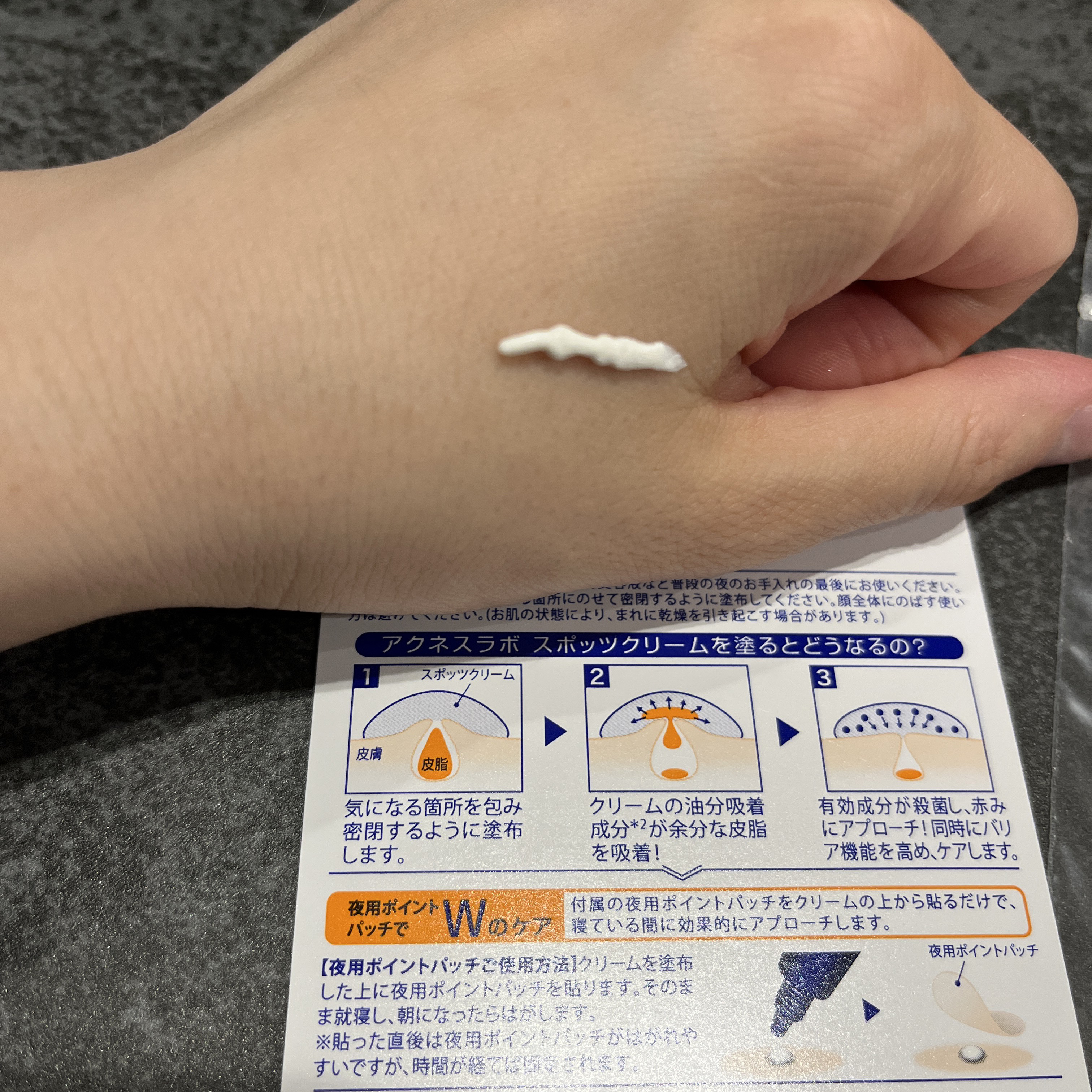 薬用ニキビケア スポッツクリーム/アクネスラボ/フェイスクリームを使ったクチコミ（2枚目）