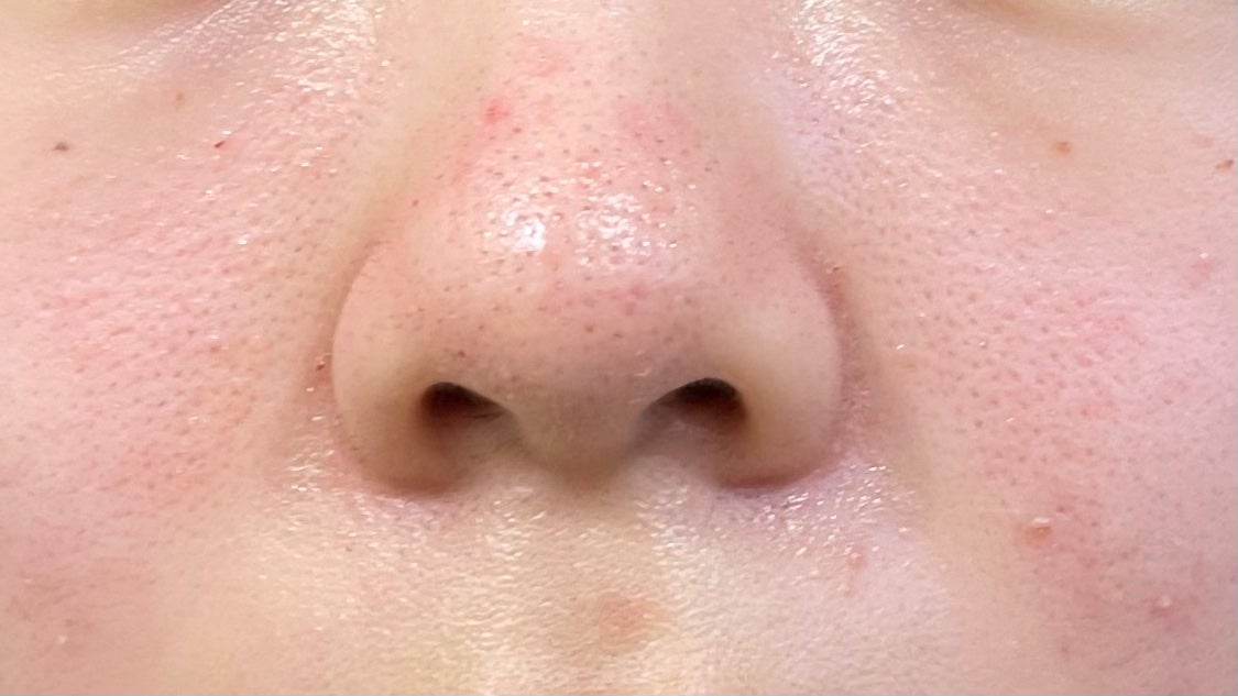 潤浸保湿 化粧水 II しっとり/キュレル/化粧水を使ったクチコミ(2枚目)