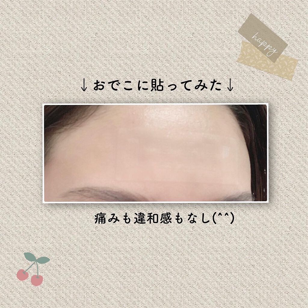 オデコディープパッチ/北の快適工房/シートマスク・パックを使ったクチコミ(4枚目)