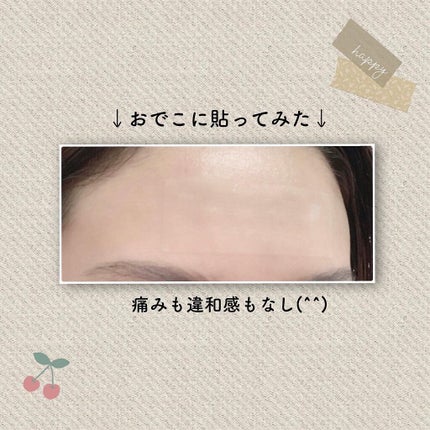 オデコディープパッチ/北の快適工房/シートマスク・パックを使ったクチコミ(4枚目)